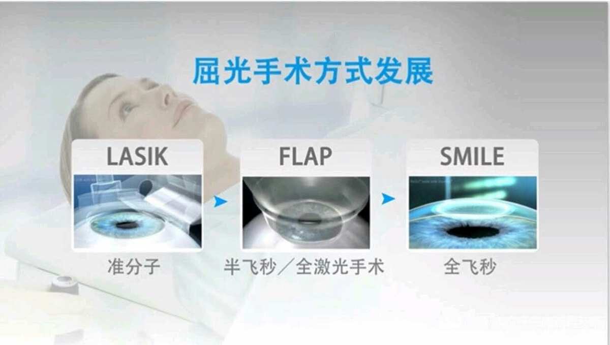 角膜激光切削手术多少钱_激光切削角膜_机械法激光上皮下角膜磨镶术