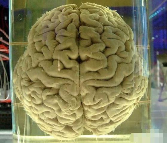死了的人回来了_活死人归来2_活死人归来生人回避