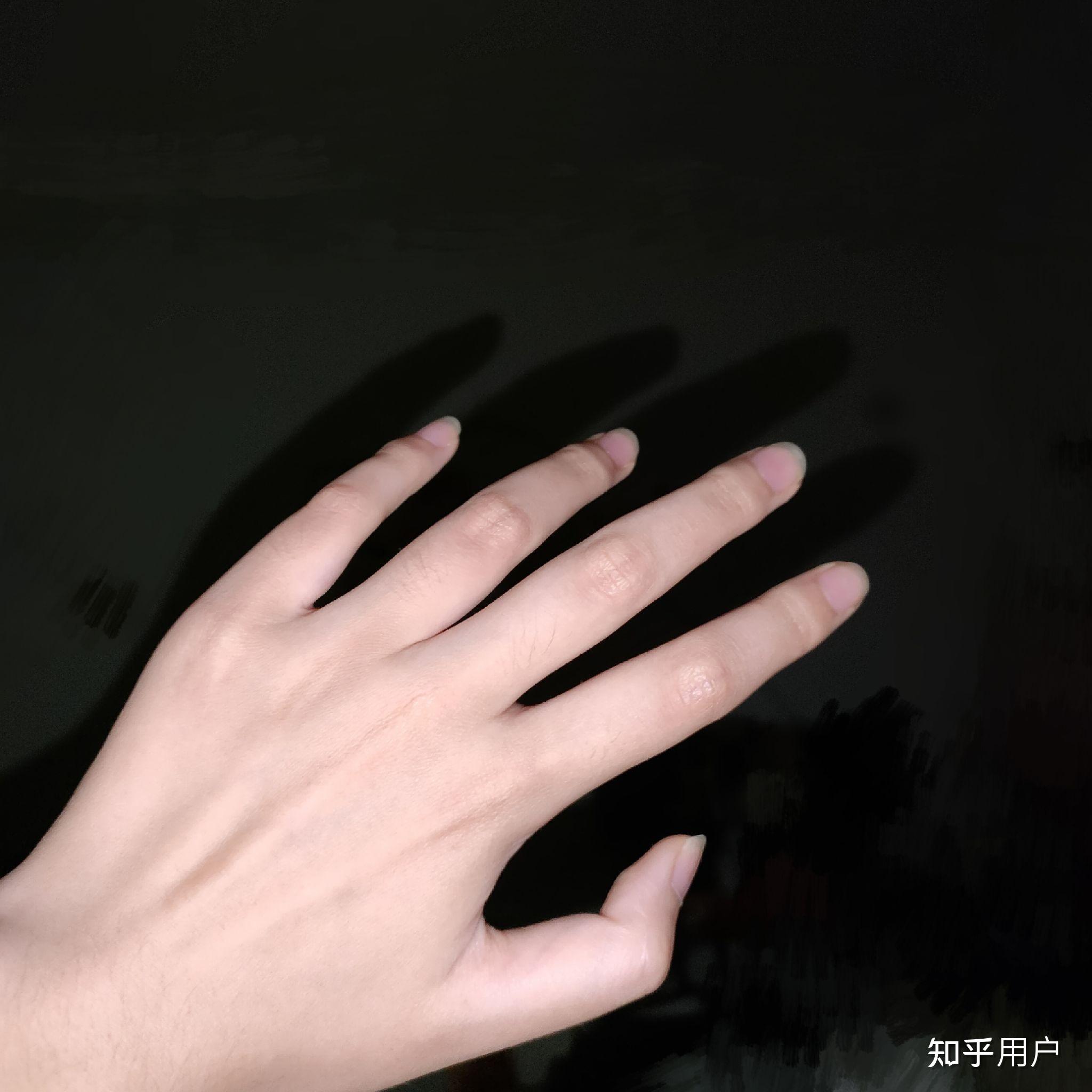 打游戏手背疼什么原因_玩手机手背上起了个包_打手机游戏手背凸出怎么办